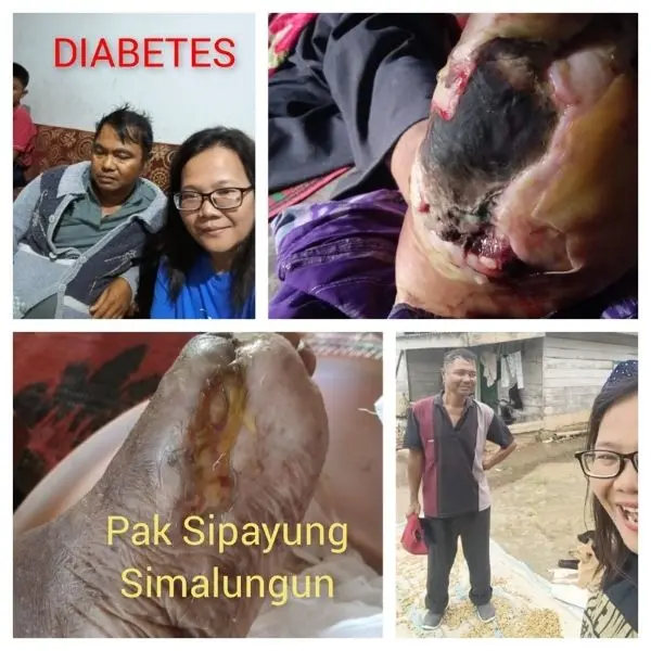 Pak Sipayung Simalungun