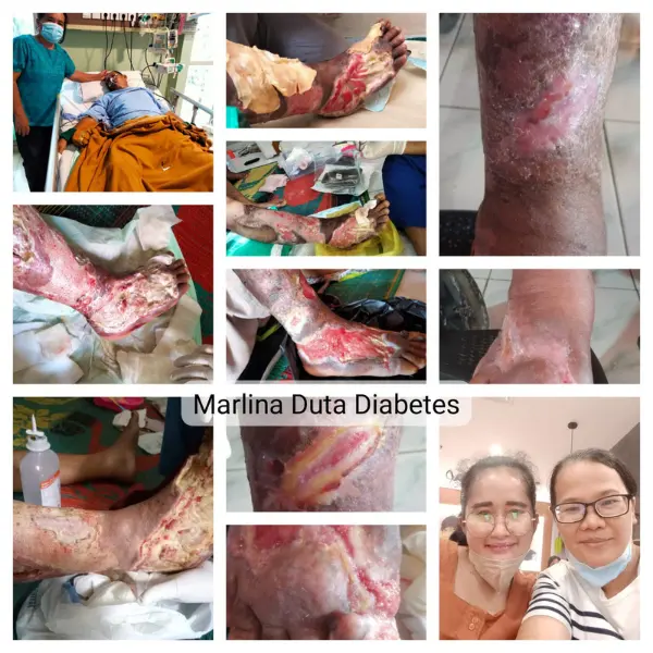 Proses Penyembuhan Awal