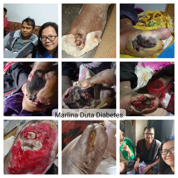 Proses Penyembuhan Lanjutan